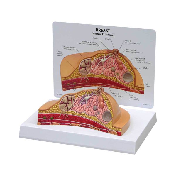3B Scientific Breast Cross-Section Model – 3B Smart Anatomy