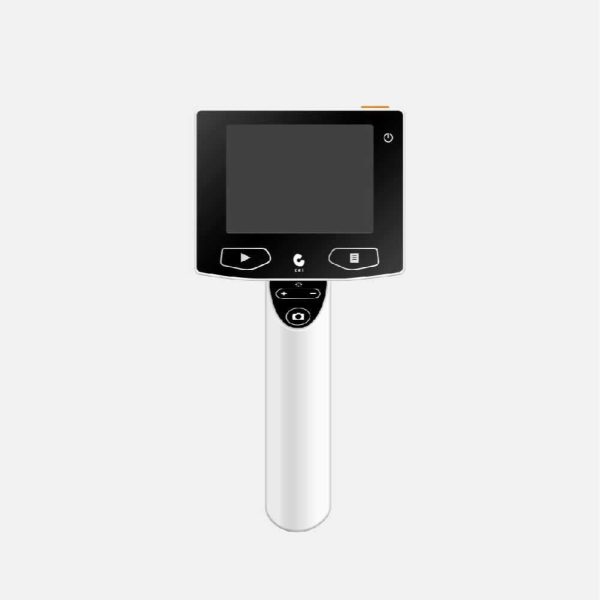 Ceitek Digital Otoscope HD Resolution DO382