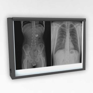 X-Ray LED Double Viewing Box