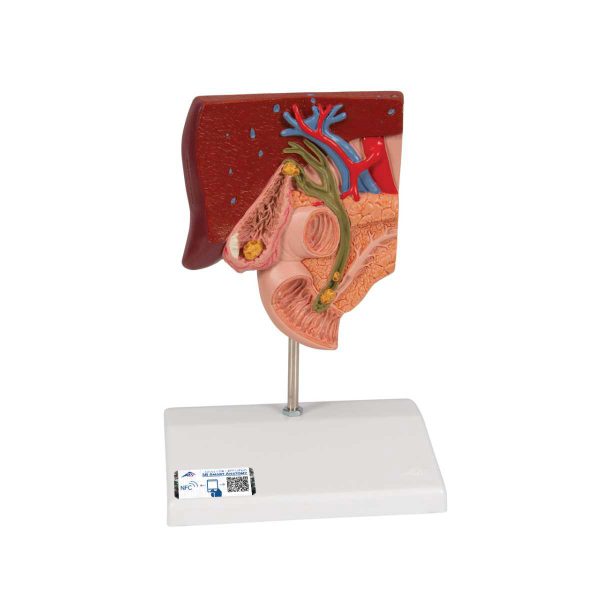 3B Scientific Gallstone Model – 3B Smart Anatomy