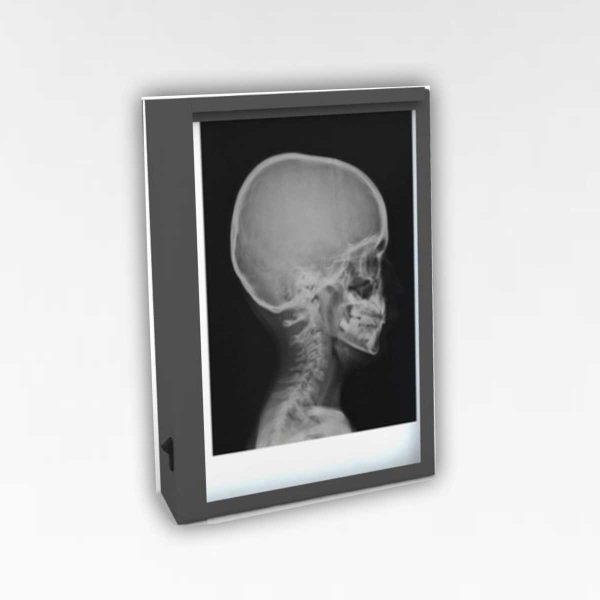 X-Ray Viewing Box - Single