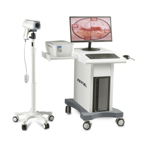 KN-2200 Video Colposcope