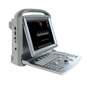 Chison ECO 5 Portable Color Doppler Ultrasound System