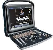Chison ECO 5 Portable Color Doppler Ultrasound System