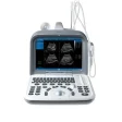 Portable ultrasound system ZQ-6602