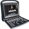 Chison ECO 5 Portable Color Doppler Ultrasound System